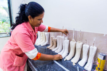 Prosthetics Orthotics SRCC