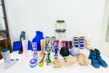 Prosthetics Orthotics variations