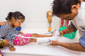 SRCC Prosthetics Orthotics